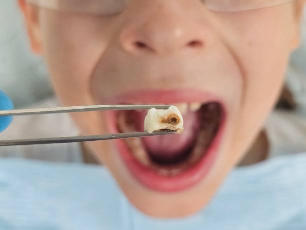 Best Emergency Dental Care for Trauma or Injury in Darnestown, MD